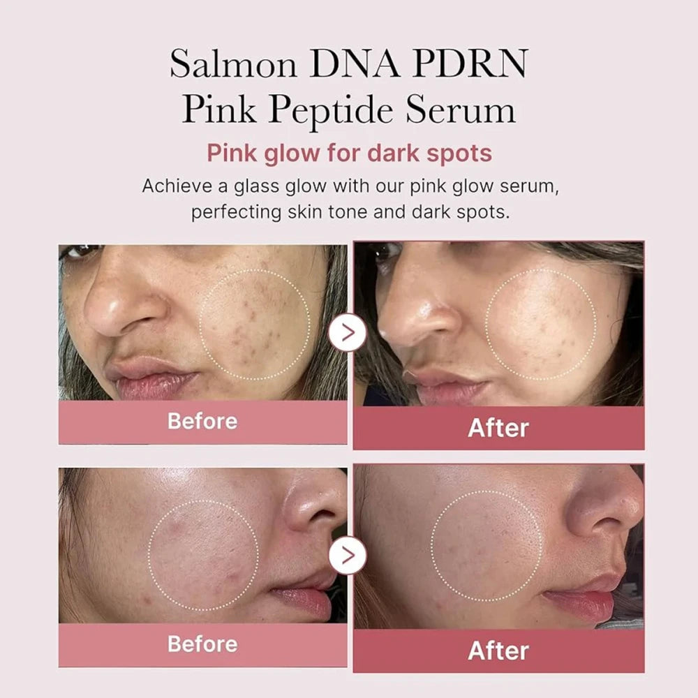 Pink Peptide Glow Serum | Hydrating & Smoothing Korean Skincare